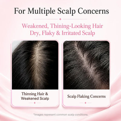 Botanical Scalp Renewal Serum